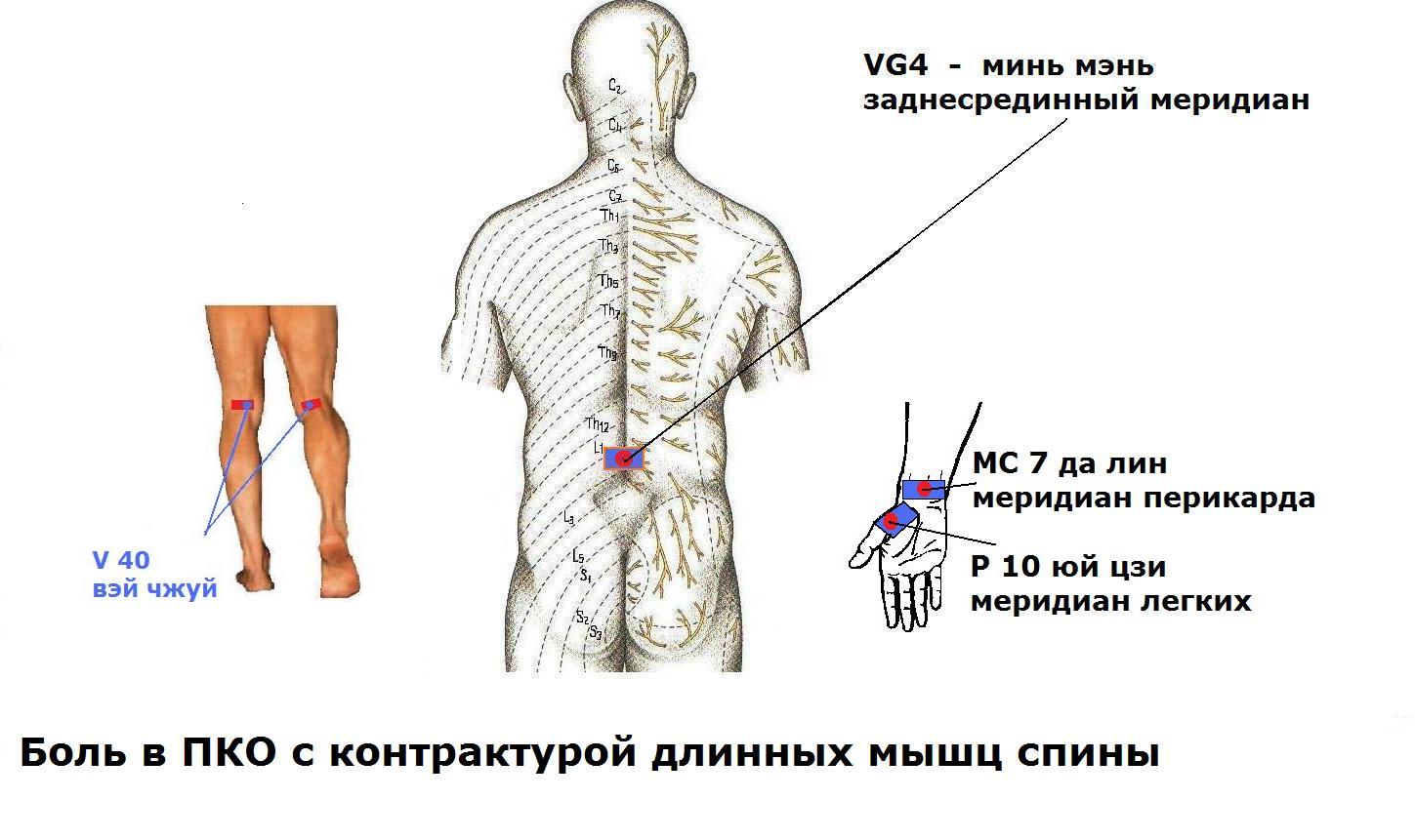 Последствия грыж грудного отдела позвоночника